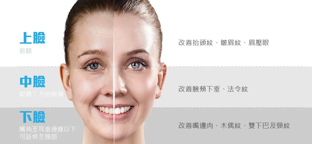 拉皮療程
