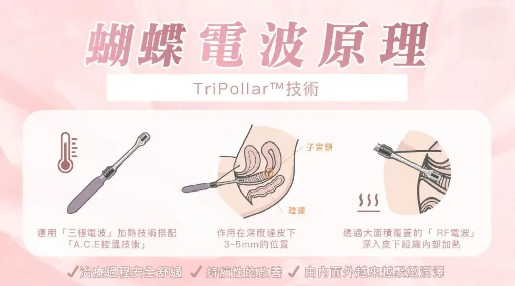 蝴蝶電波
